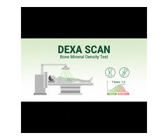 DEXA Scan Price: Cost, Factors & What You Need to Know