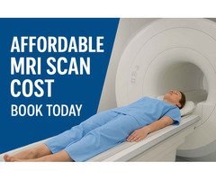 Affordable MRI Scan Cost in Delhi – Book Today - 1